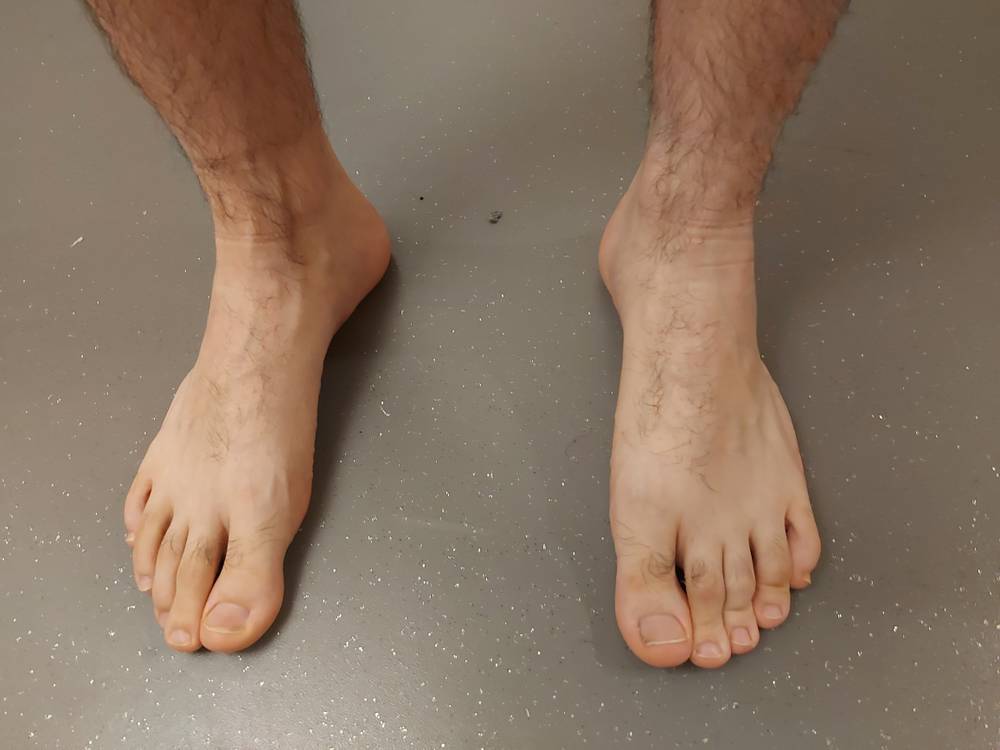 Brazilian/Euro Male Feet OnlyFans – free nudes, naked, leaked