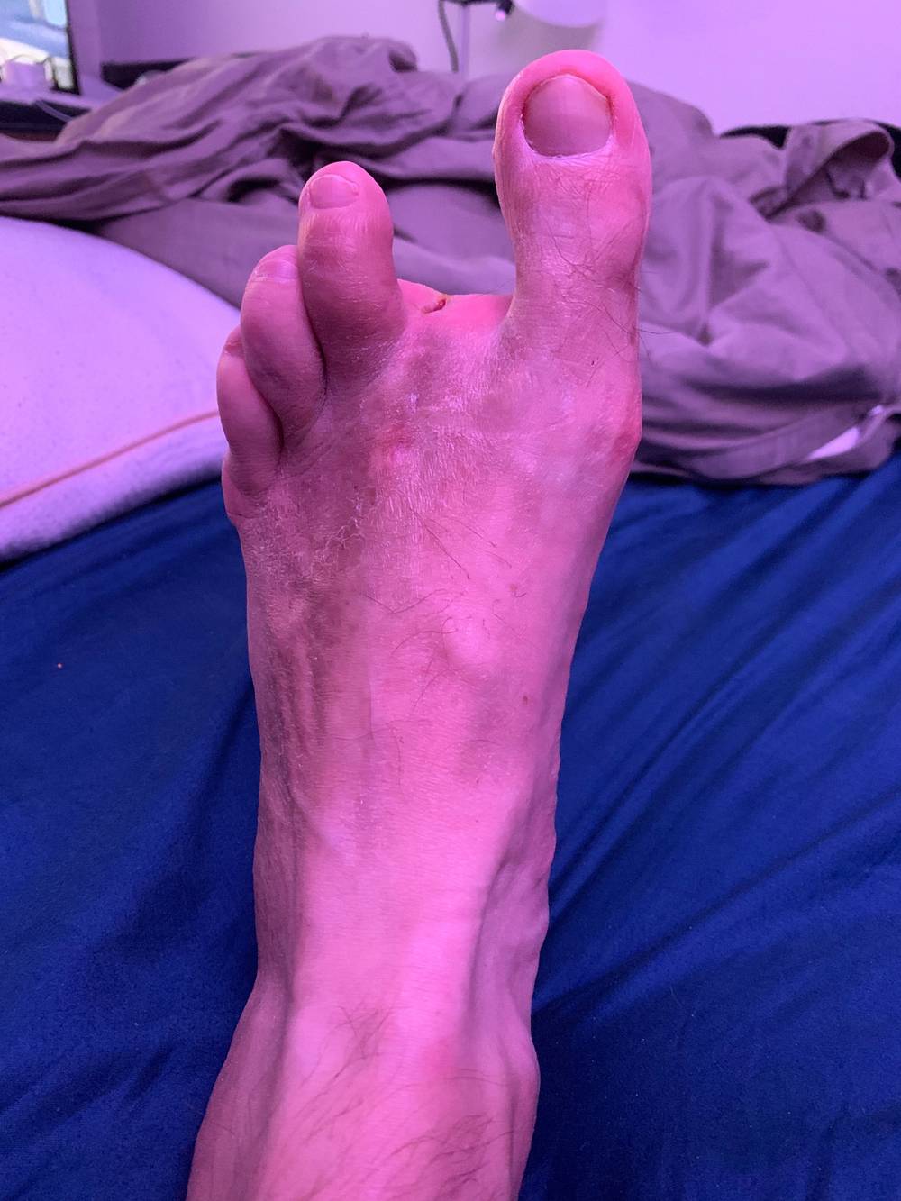 Andy’s strange foot OnlyFans – free nudes, naked, leaked