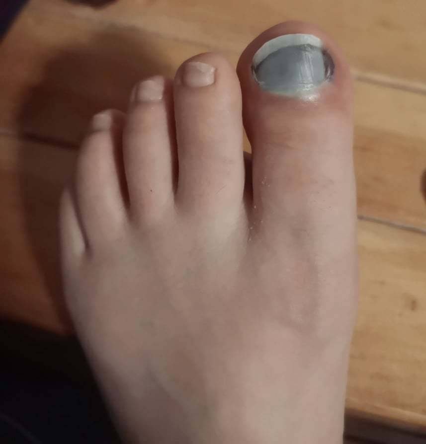 Foot Godess OnlyFans – free nudes, naked, leaked