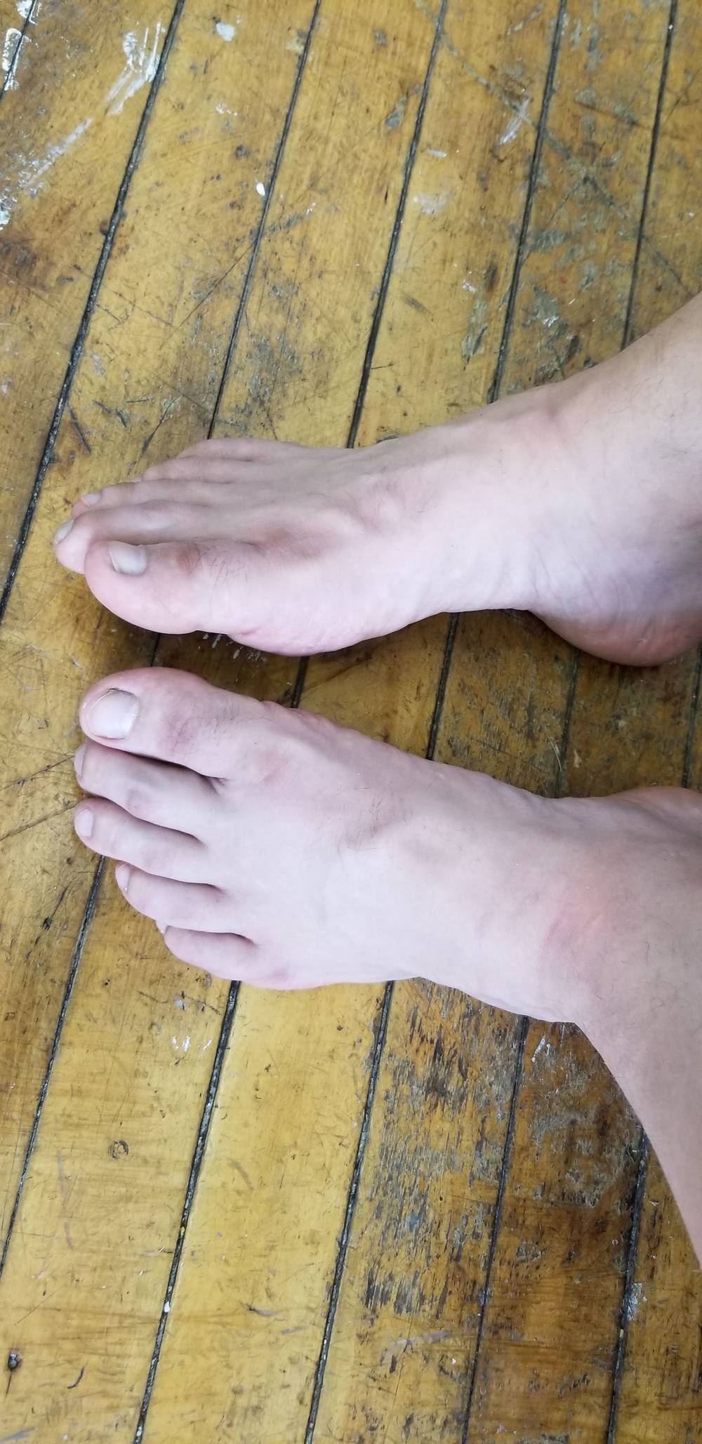 Bostonfeet OnlyFans – free nudes, naked, leaked