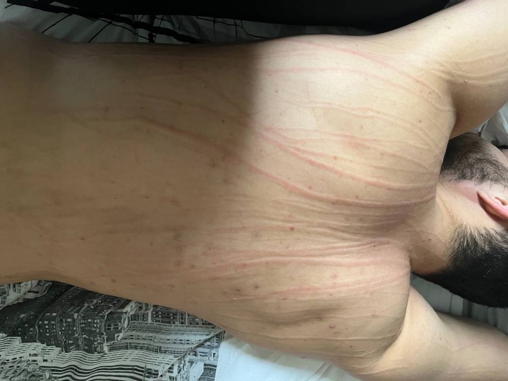 Nails Scratching OnlyFans – free nudes, naked, leaked